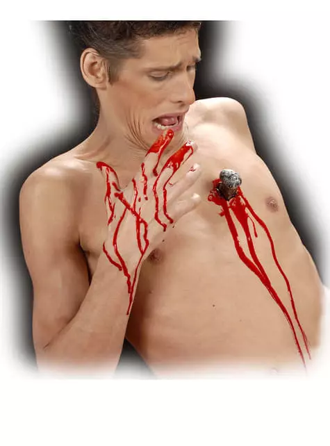 Perforación De Clavo